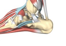 Ankle Ligament Reconstruction