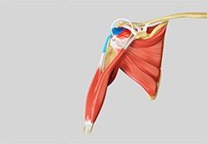 Subacromial Decompression