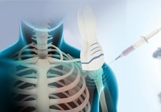 Ultrasound-Guided Shoulder Injections